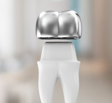 What Can You Expect During a Dental Crown Procedure?