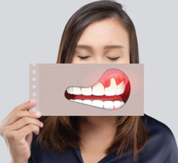 What are the Symptoms of Gum Disease, and How Can I Prevent it?