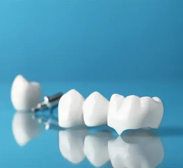 CEREC® Crowns: Benefits of One-Visit Crown Technology