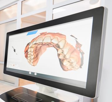 How Often Should You Have an Oral Cancer Screening?